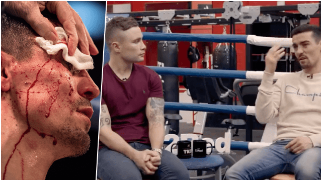 Ahead of trickiest test in boxing, Anthony Crolla recalls burglar attack which could have killed him