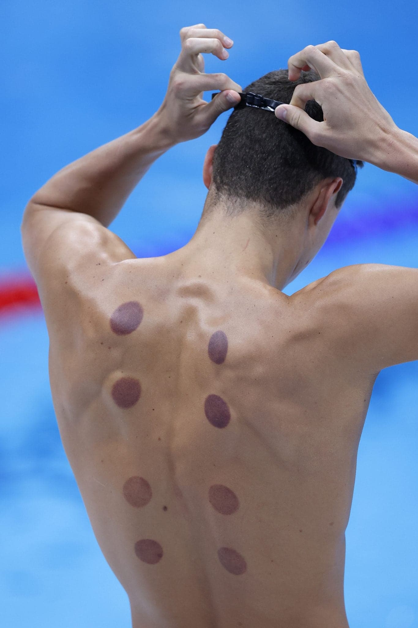 What are the dark circles on swimmers backs at Tokyo Olympics?