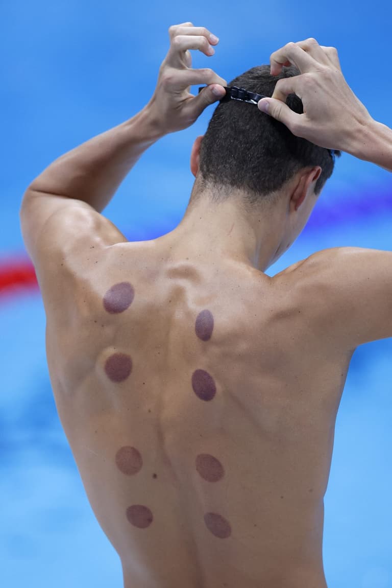 What are the dark circles on swimmers backs at Tokyo Olympics?