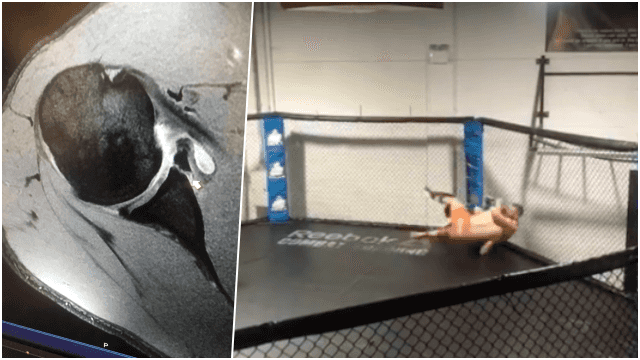 EXCLUSIVE: The moment Will Fleury suffered serious shoulder injury before Bellator Dublin EXCLUSIVE: The moment Will Fleury suffered serious shoulder injury before Bellator Dublin