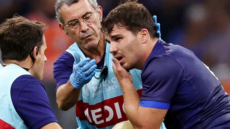 Antoine Dupont rushed to hospital with suspected broken jaw in France win Antoine Dupont rushed to hospital with suspected broken jaw in France win