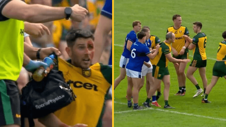 Footage shows dirty punch that gave red to Kerry star & bloody face to McHugh Footage shows dirty punch that gave red to Kerry star & bloody face to McHugh
