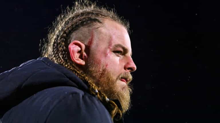 “Bloody accident” – Rugby legends react to red card for horrific Finlay Bealham incident “Bloody accident” – Rugby legends react to red card for horrific Finlay Bealham incident