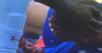 GRAPHIC: Blood was streaming from Steven Fletcher’s head after clash with Tommy Elphick