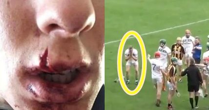 The cowardly belt that left Ross King with a split lip and with two teeth knocked back